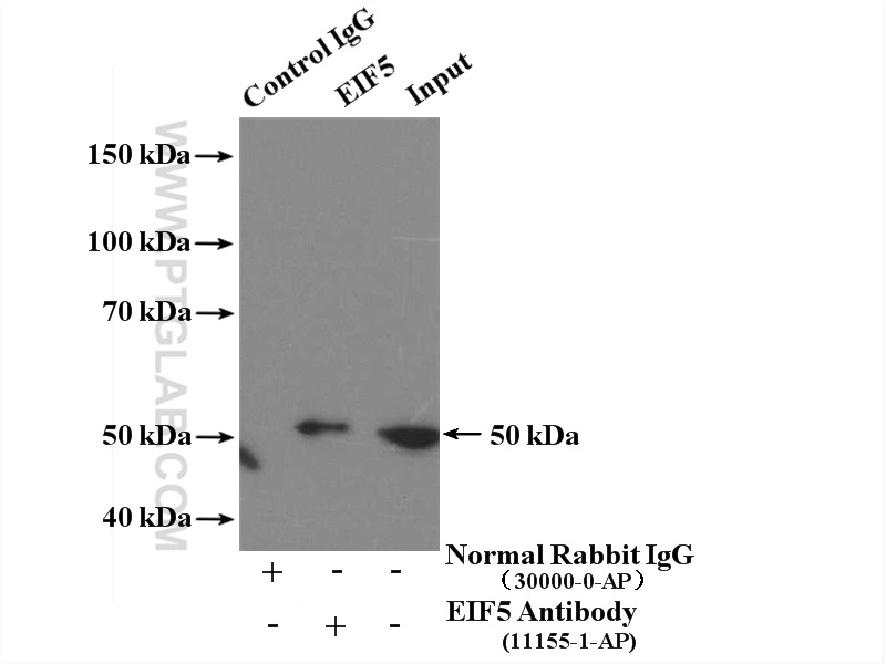 Immunoprecipitation (IP) experiment of HeLa cells using EIF5 Polyclonal antibody (11155-1-AP)