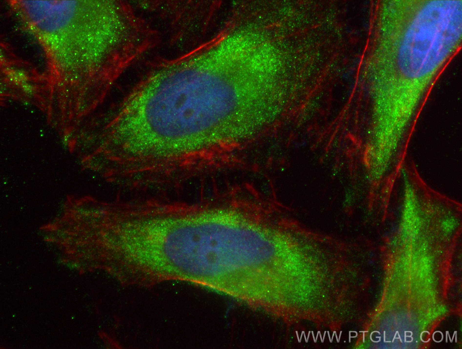 Immunofluorescence (IF) / fluorescent staining of HeLa cells using EIF5A Polyclonal antibody (11309-1-AP)