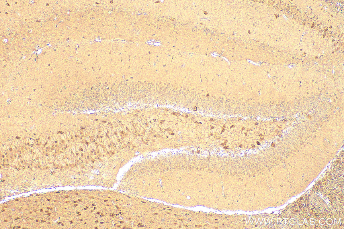 Immunohistochemistry (IHC) staining of mouse brain tissue using EIF5A1/EIF5A2 Polyclonal antibody (17069-1-AP)