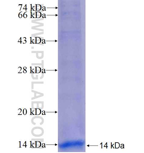 ELA2A fusion protein Ag25017 SDS-PAGE