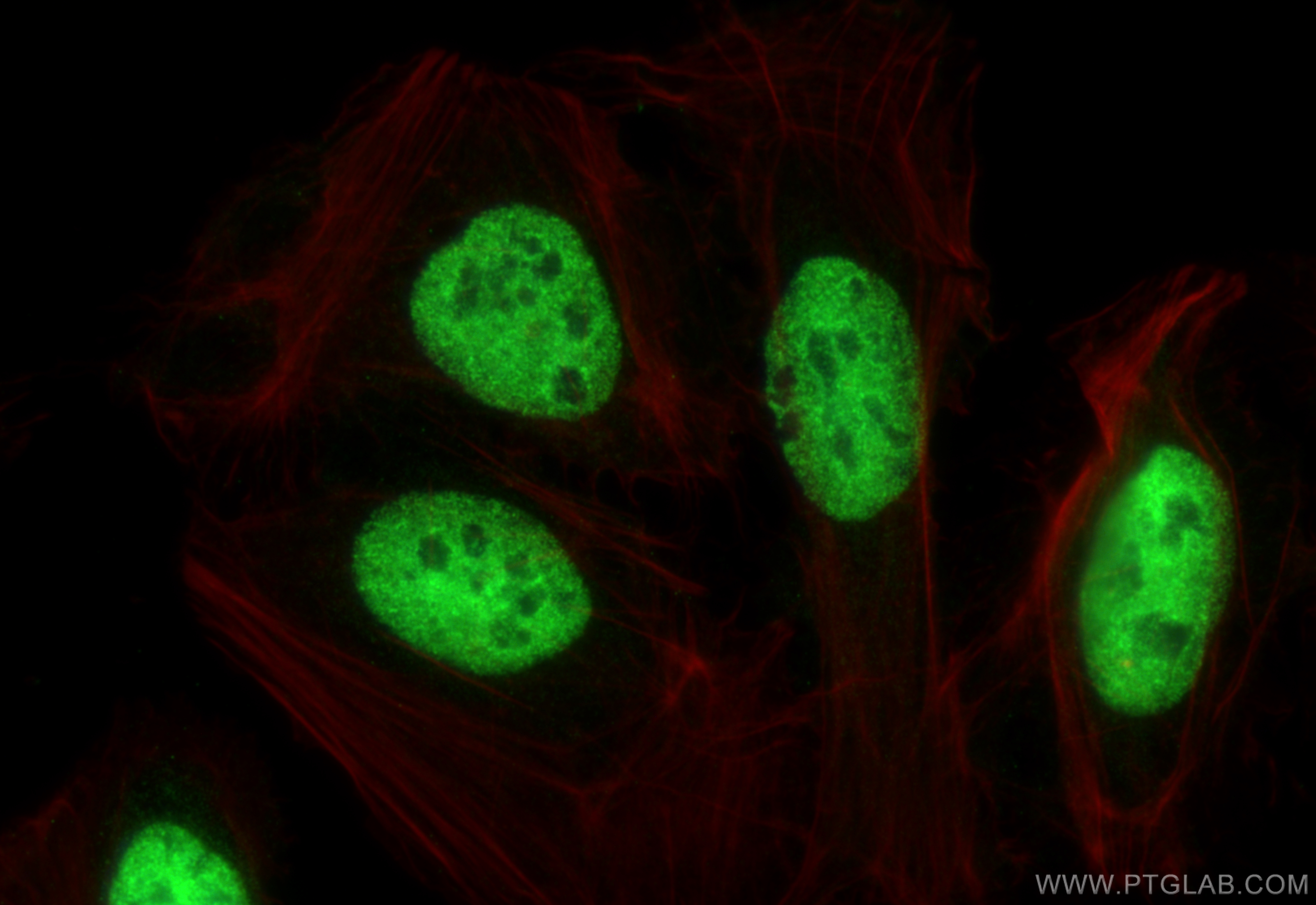 Immunofluorescence (IF) / fluorescent staining of U2OS cells using ELAVL4 Monoclonal antibody (67835-1-Ig)