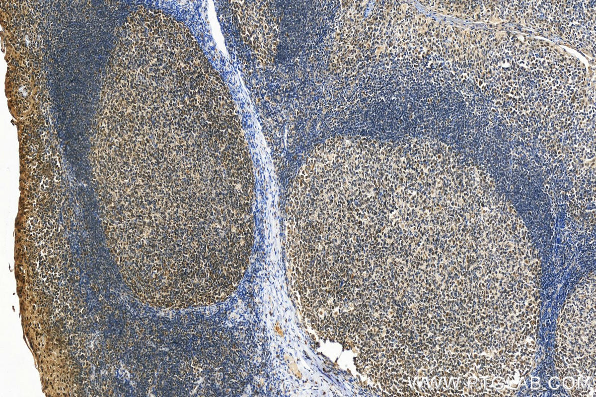 Immunohistochemistry (IHC) staining of human tonsillitis tissue using ELF1 Polyclonal antibody (22565-1-AP)