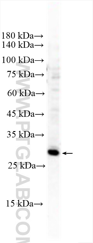 Western Blot (WB) analysis of T-47D cells using ELF5 Polyclonal antibody (13107-1-AP)