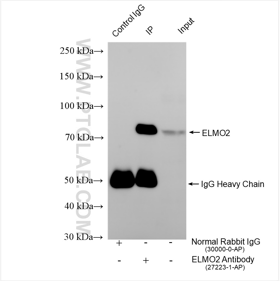 Immunoprecipitation (IP) experiment of BT-549 cells using ELMO2 Polyclonal antibody (27223-1-AP)