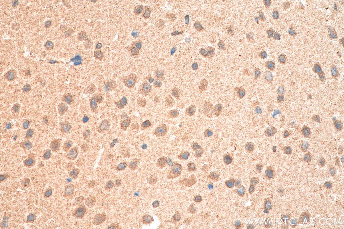 Immunohistochemistry (IHC) staining of mouse brain tissue using ELOVL4 Polyclonal antibody (55023-1-AP)