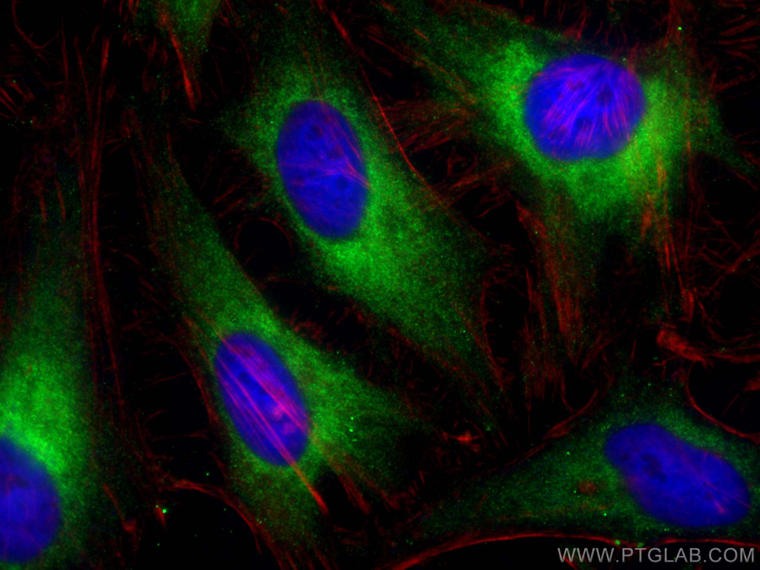 Immunofluorescence (IF) / fluorescent staining of HeLa cells using ELOVL5 Polyclonal antibody (26599-1-AP)