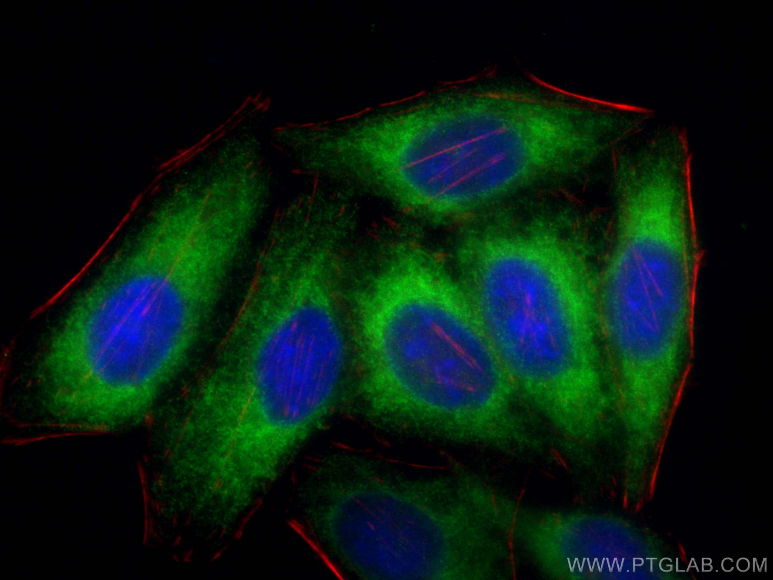 Immunofluorescence (IF) / fluorescent staining of HepG2 cells using ELOVL5 Polyclonal antibody (26599-1-AP)