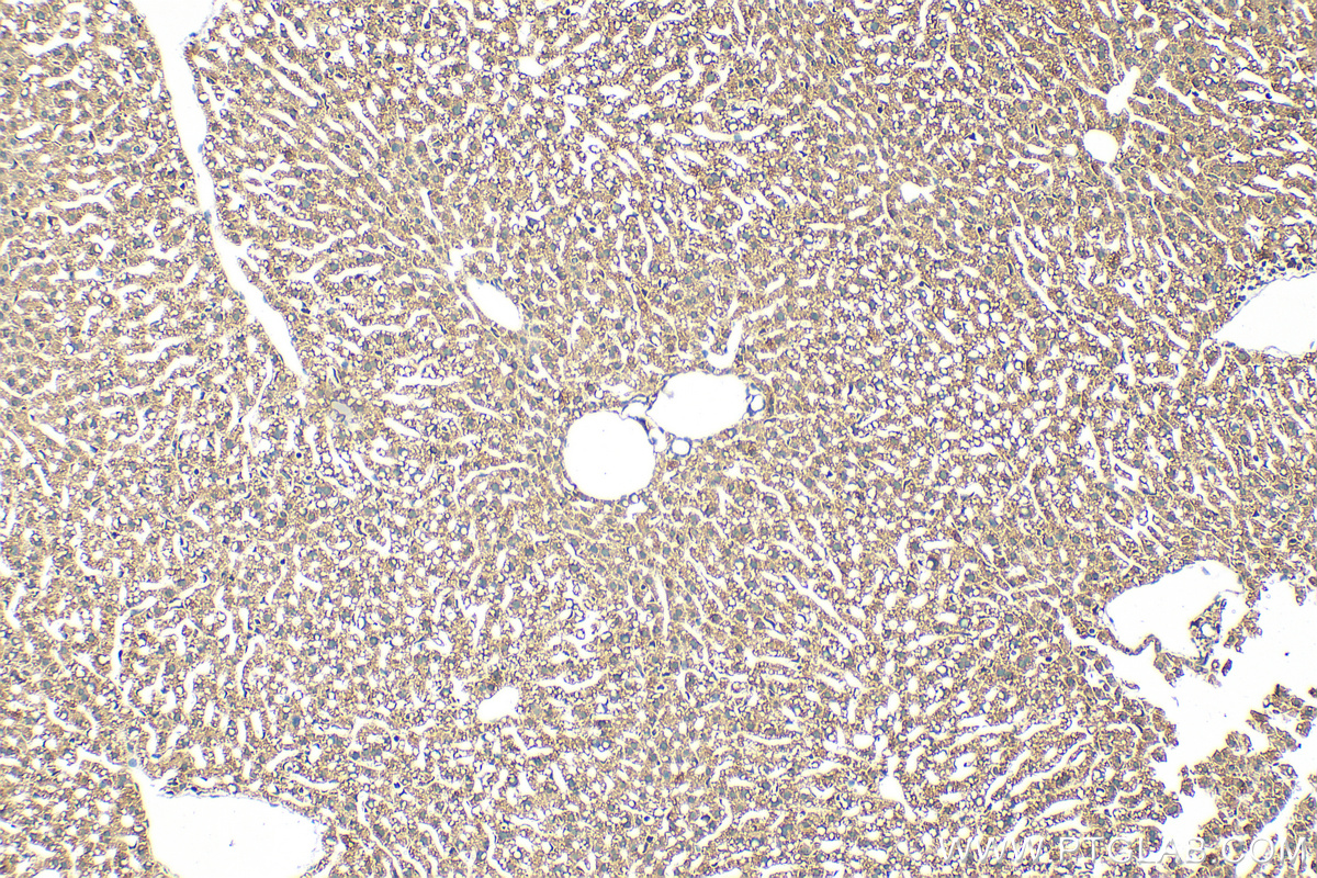 Immunohistochemistry (IHC) staining of mouse liver tissue using ELOVL5 Polyclonal antibody (26599-1-AP)