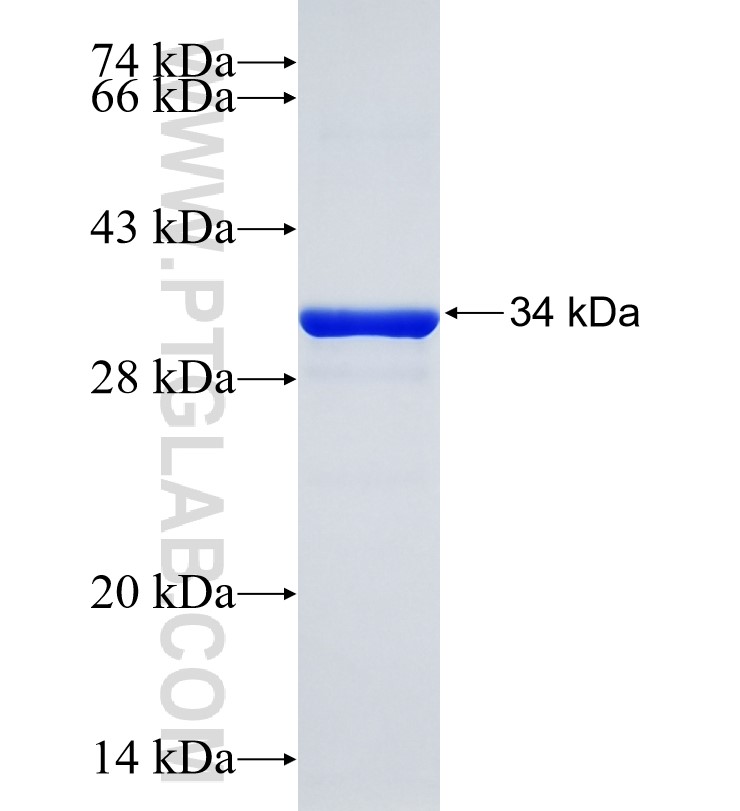 ELOVL5 fusion protein Ag24896 SDS-PAGE