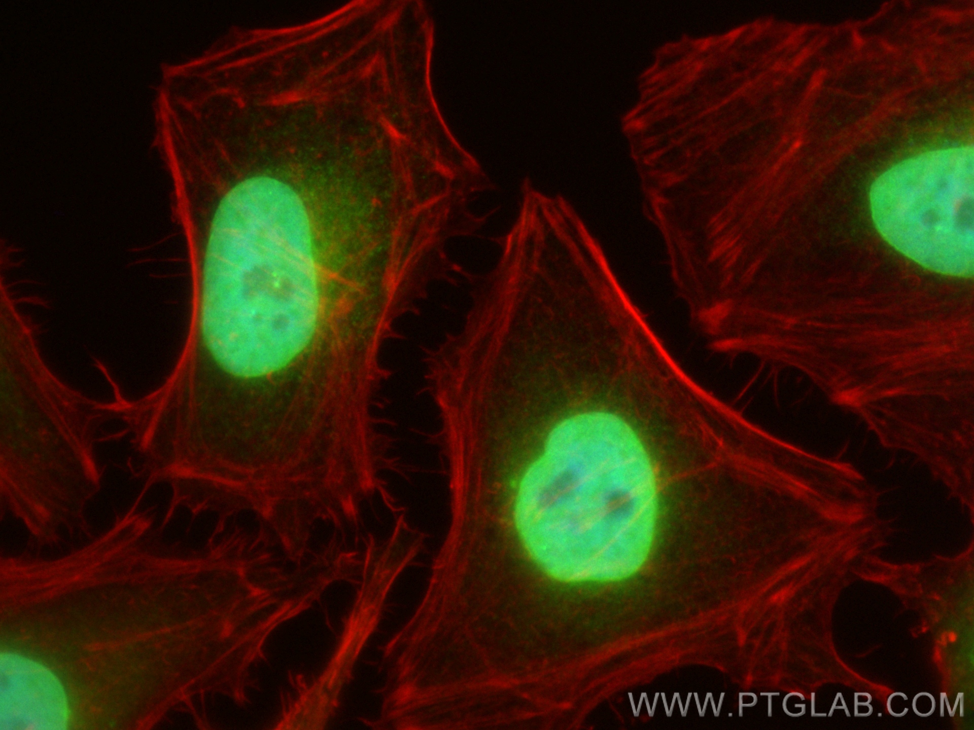 Immunofluorescence (IF) / fluorescent staining of HeLa cells using Emerin Recombinant antibody (82888-2-RR)