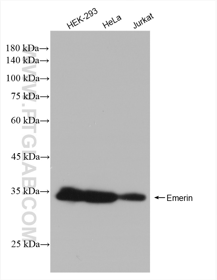 Western Blot (WB) analysis of various lysates using Emerin Recombinant antibody (82888-3-RR)