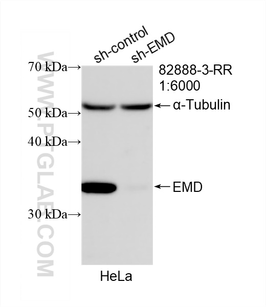 Western Blot (WB) analysis of HeLa cells using Emerin Recombinant antibody (82888-3-RR)