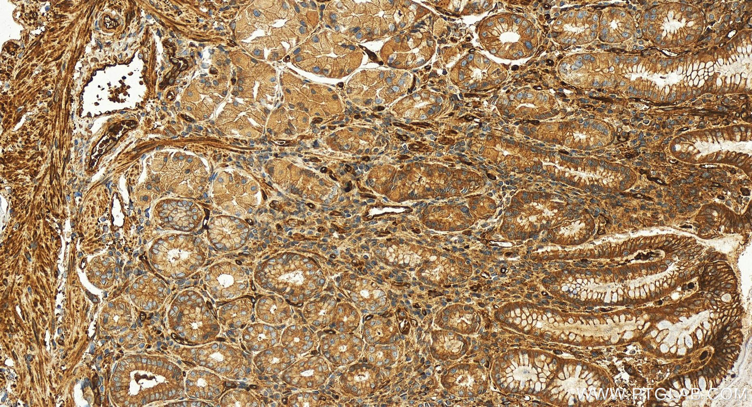 Immunohistochemistry (IHC) staining of human stomach tissue using EML1 Polyclonal antibody (12765-1-AP)