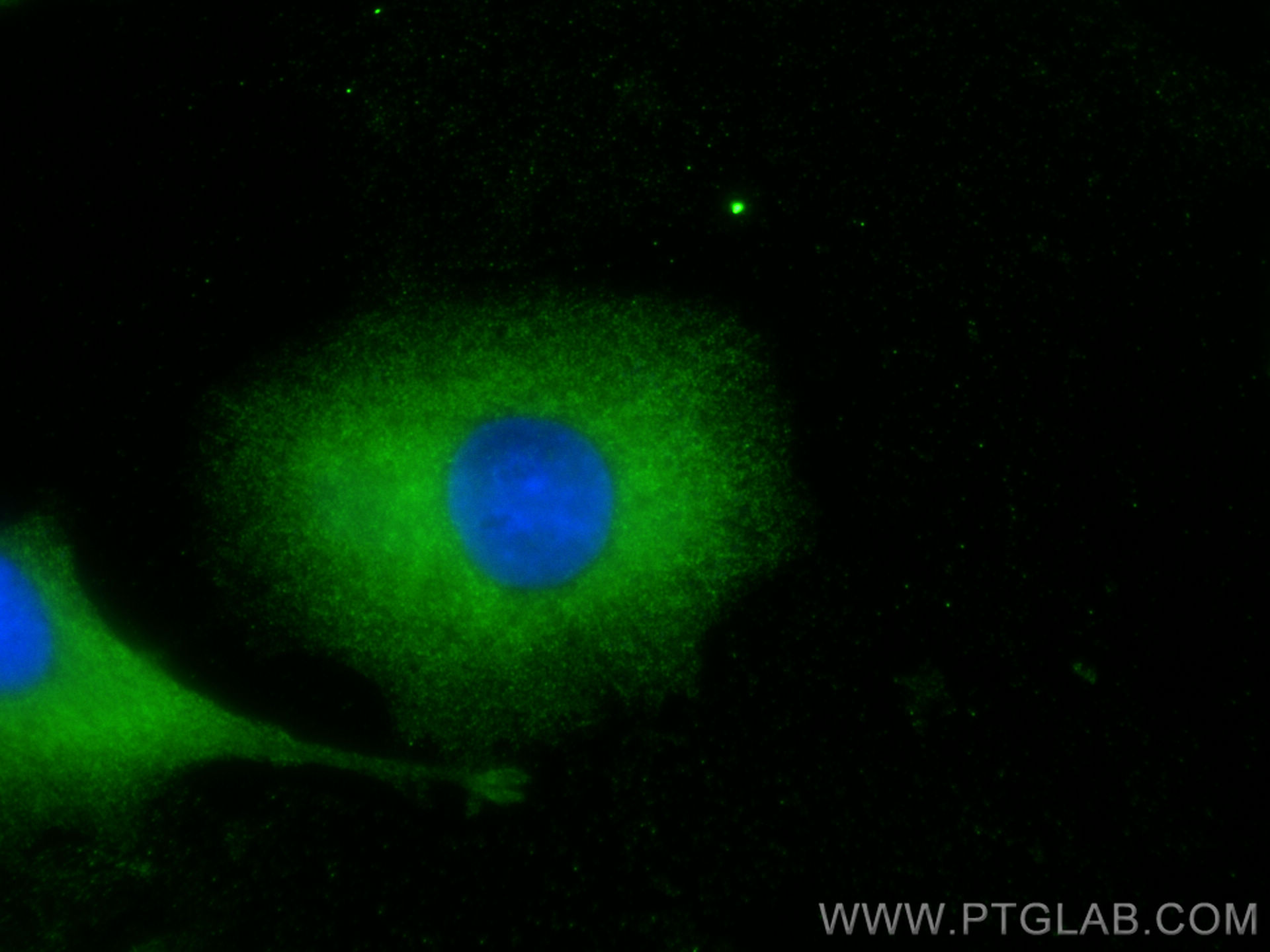 Immunofluorescence (IF) / fluorescent staining of A549 cells using EML4 Polyclonal antibody (22709-1-AP)