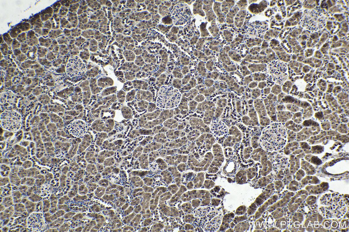 Immunohistochemistry (IHC) staining of rat kidney tissue using EMX1 Polyclonal antibody (55032-1-AP)