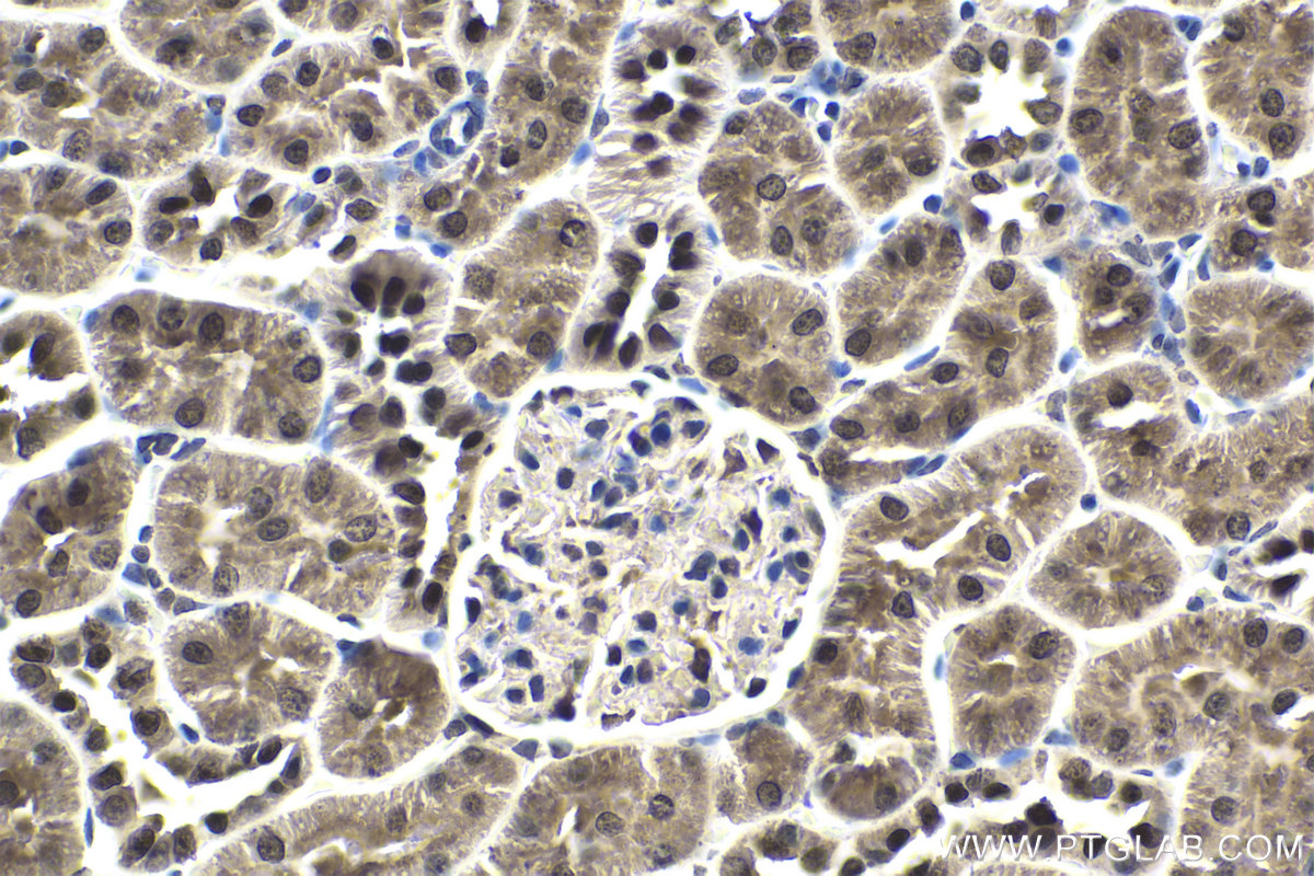 Immunohistochemistry (IHC) staining of rat kidney tissue using EMX1 Polyclonal antibody (55032-1-AP)