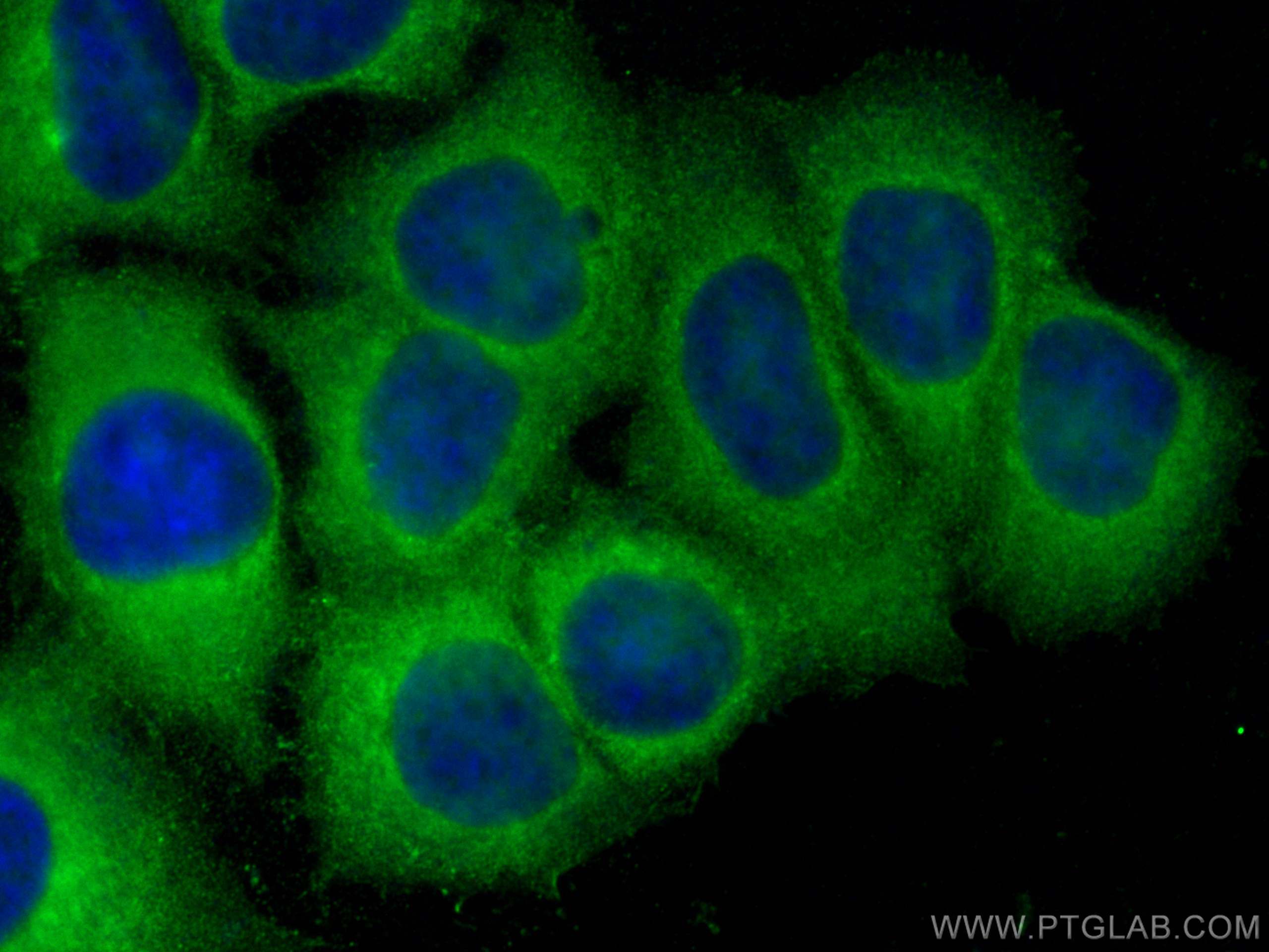 Immunofluorescence (IF) / fluorescent staining of MCF-7 cells using ENAH Polyclonal antibody (26421-1-AP)