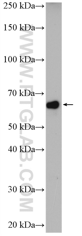 Western Blot (WB) analysis of SH-SY5Y cells using ENC1 Polyclonal antibody (15007-1-AP)