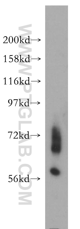 Western Blot (WB) analysis of mouse brain tissue using ENC1 Polyclonal antibody (15007-1-AP)