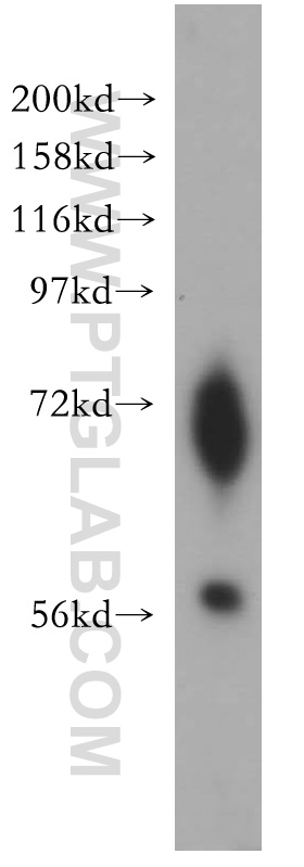 Western Blot (WB) analysis of human lung tissue using ENC1 Polyclonal antibody (15007-1-AP)