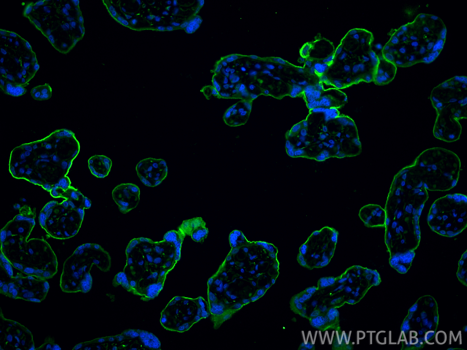 Immunofluorescence (IF) / fluorescent staining of human placenta tissue using Endoglin/CD105 Polyclonal antibody (10862-1-AP)