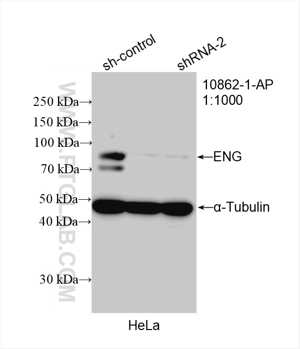 Western Blot (WB) analysis of HeLa cells using Endoglin/CD105 Polyclonal antibody (10862-1-AP)
