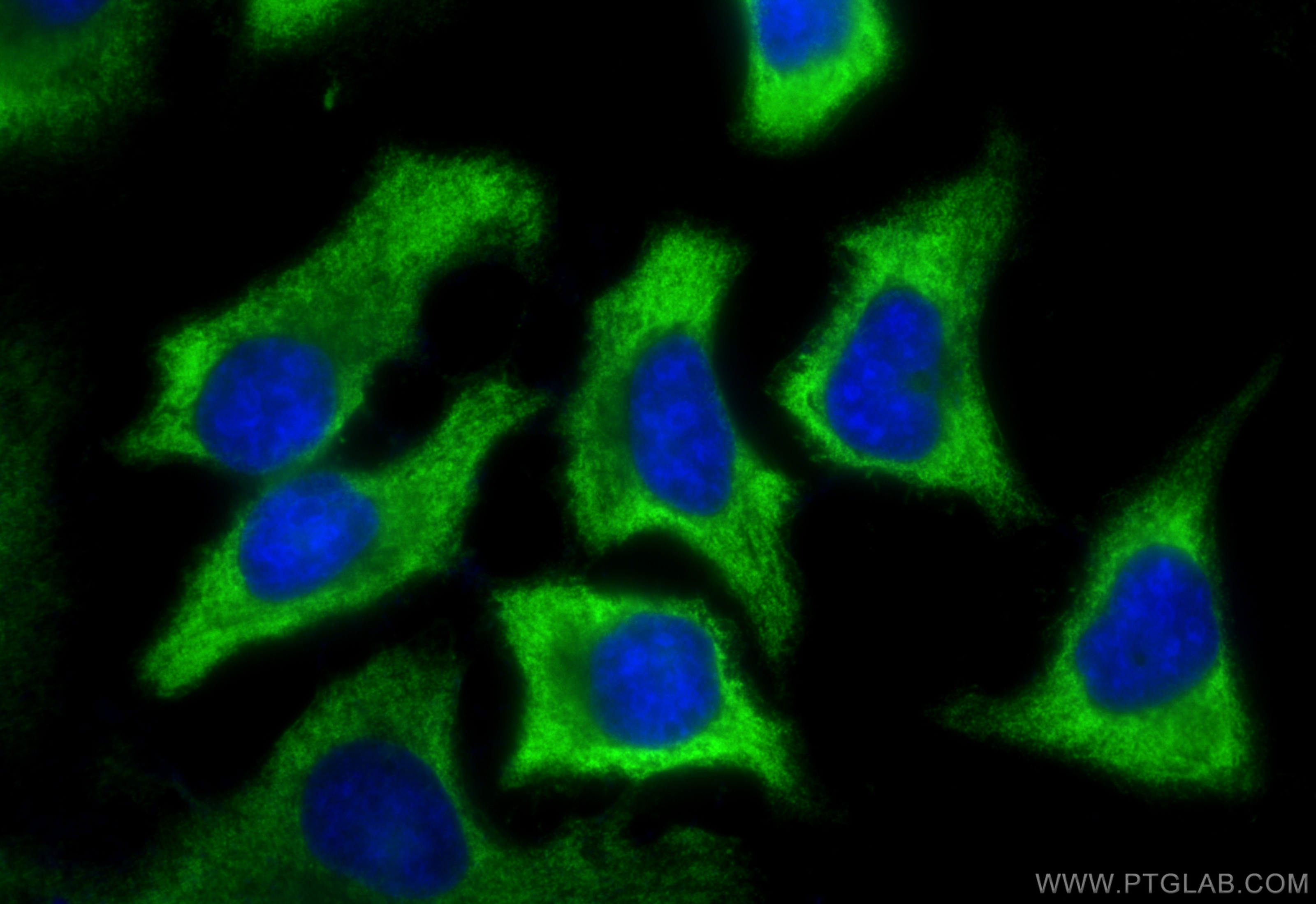 Immunofluorescence (IF) / fluorescent staining of HeLa cells using ENO1 Monoclonal antibody (67187-1-Ig)