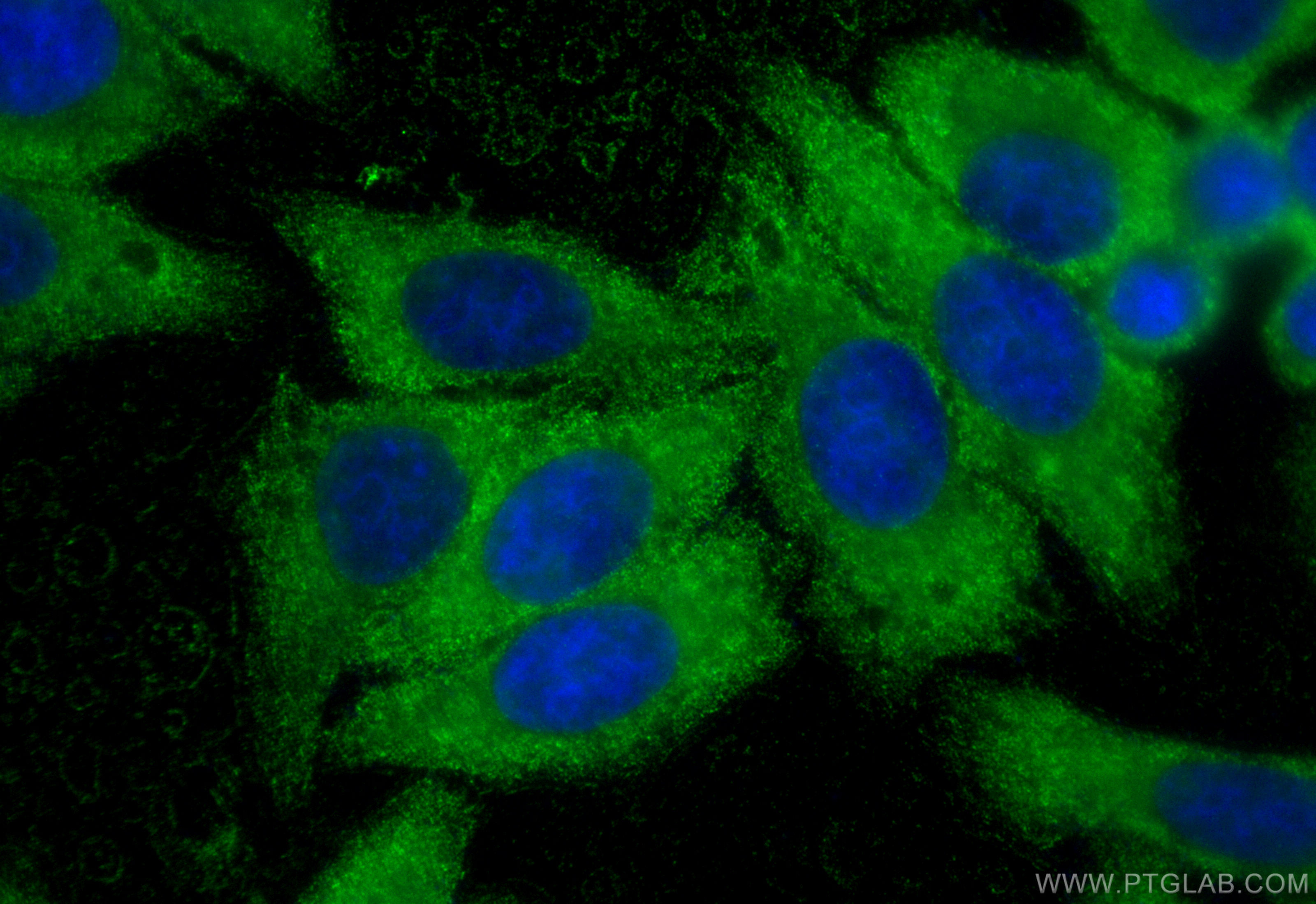 Immunofluorescence (IF) / fluorescent staining of HepG2 cells using ENO1 Monoclonal antibody (67187-1-Ig)
