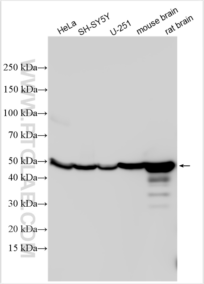 Western Blot (WB) analysis of various lysates using NSE Polyclonal antibody (10149-1-AP)