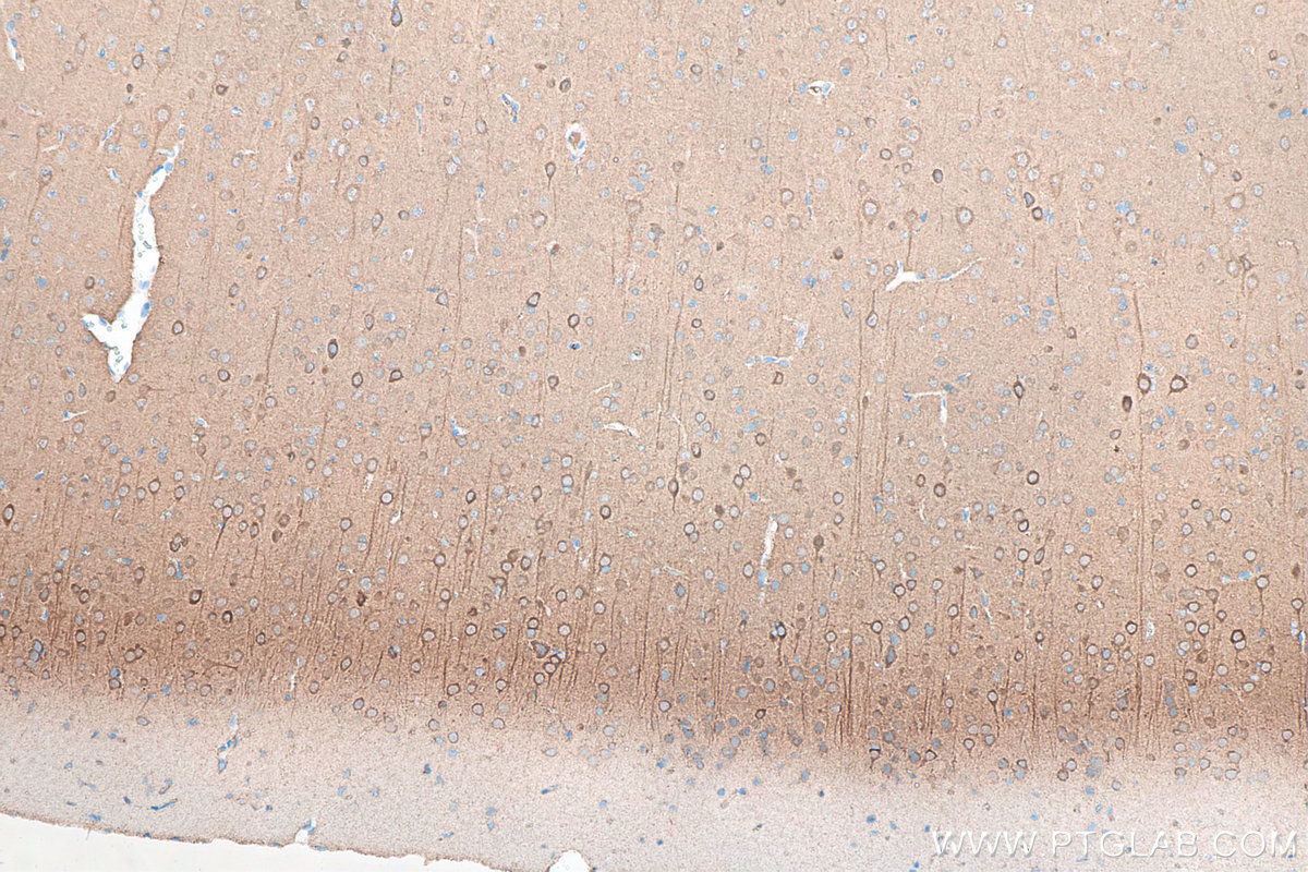 Immunohistochemistry (IHC) staining of rat brain tissue using NSE Monoclonal antibody (66150-1-Ig)