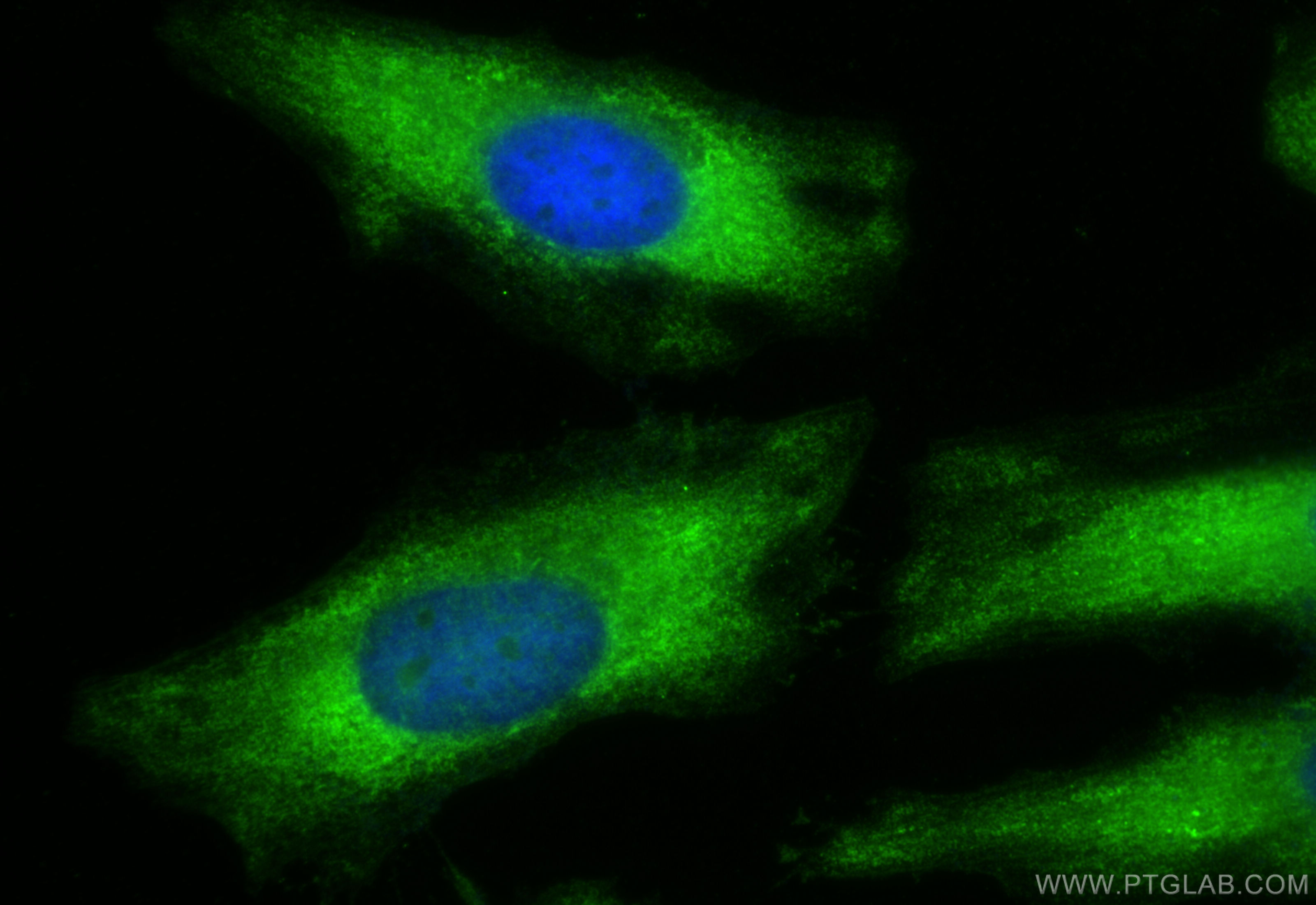 Immunofluorescence (IF) / fluorescent staining of HeLa cells using ENO3 Polyclonal antibody (16421-1-AP)