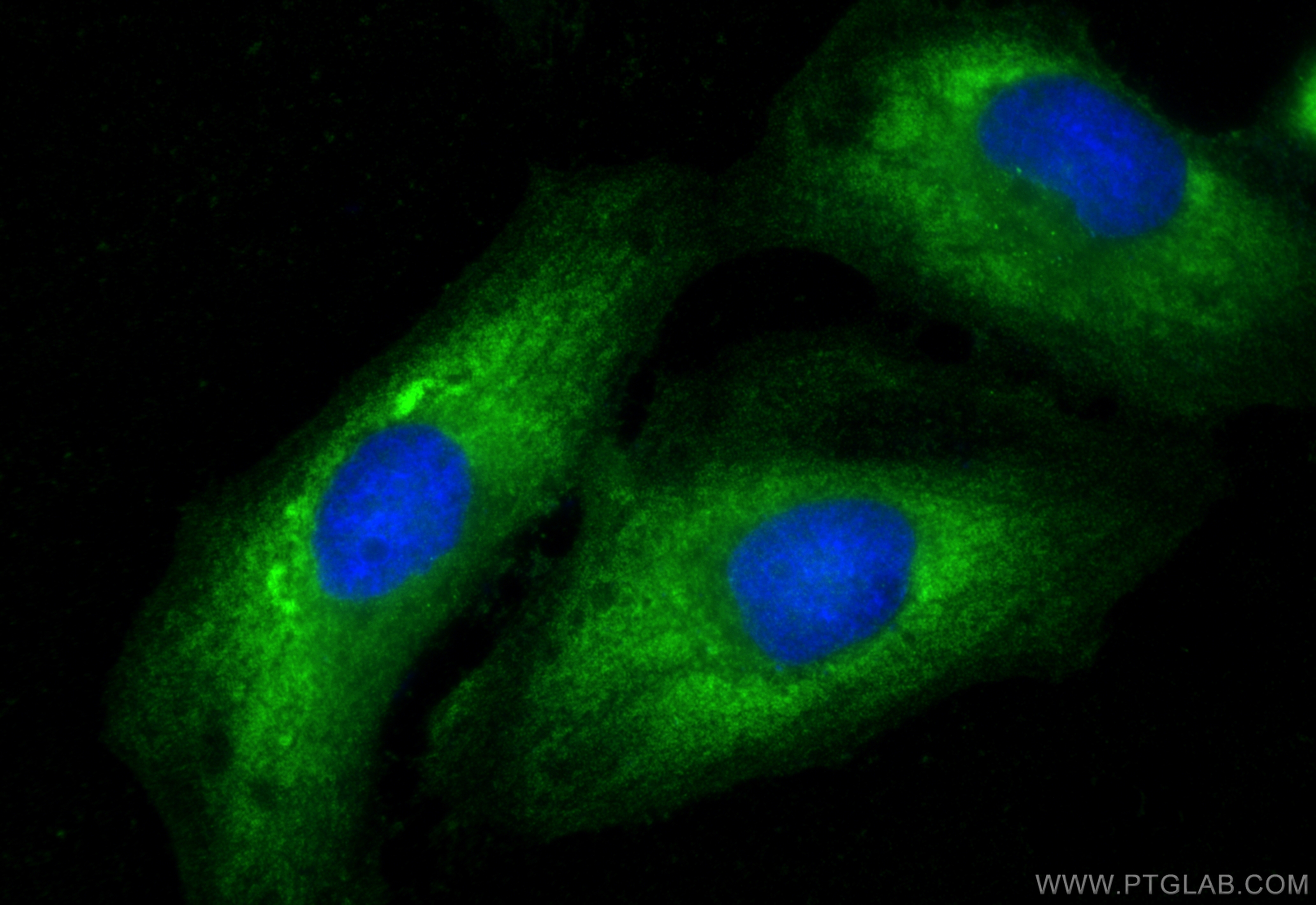 Immunofluorescence (IF) / fluorescent staining of HeLa cells using ENO3-specific Polyclonal antibody (55234-1-AP)