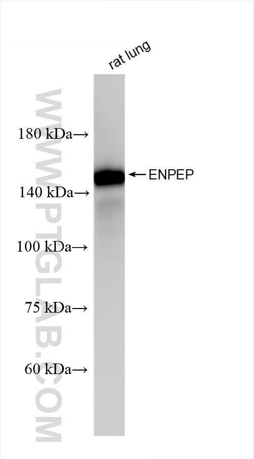 Western Blot (WB) analysis of rat lung tissue using ENPEP Recombinant antibody (85963-1-RR)