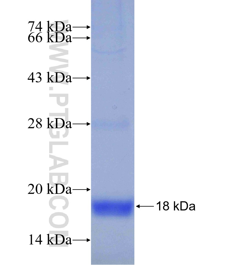 ENPP5 fusion protein Ag29596 SDS-PAGE