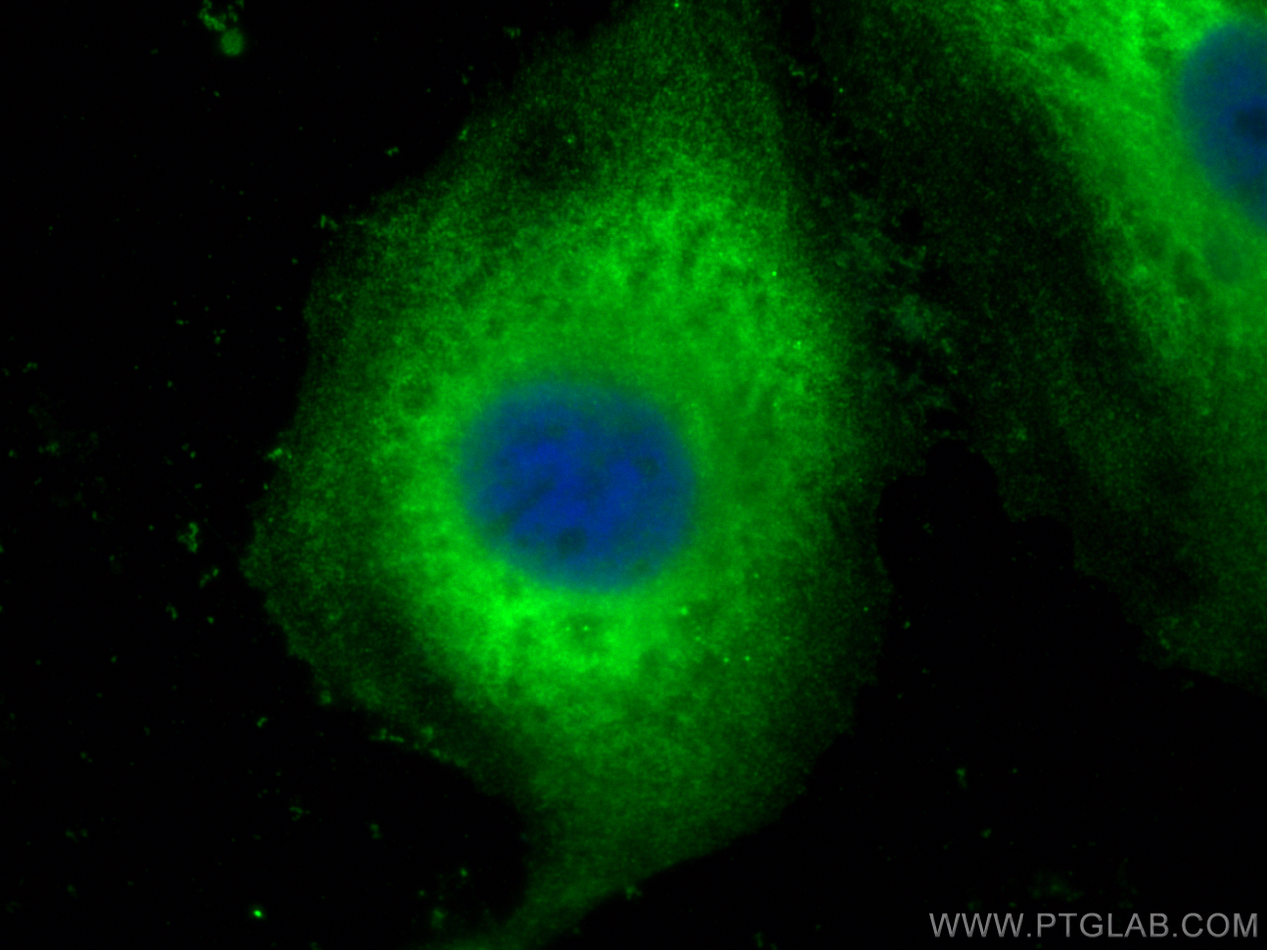 Immunofluorescence (IF) / fluorescent staining of HeLa cells using ENSA Polyclonal antibody (14518-1-AP)