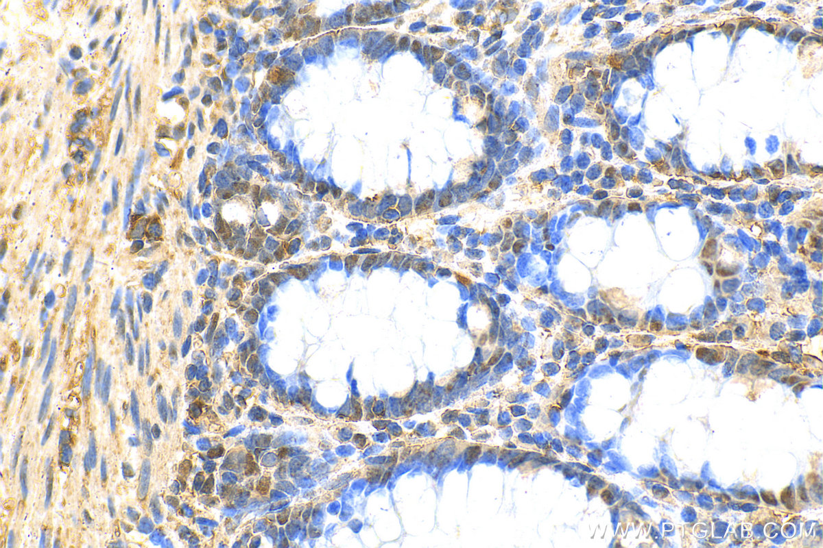 Immunohistochemistry (IHC) staining of human colon tissue using ENSA Polyclonal antibody (14518-1-AP)