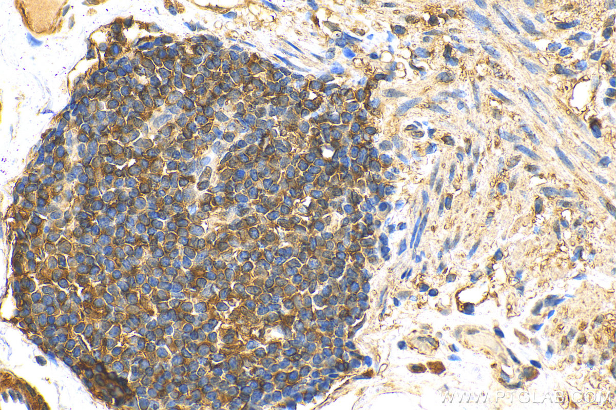 Immunohistochemistry (IHC) staining of human colon tissue using ENSA Polyclonal antibody (14518-1-AP)