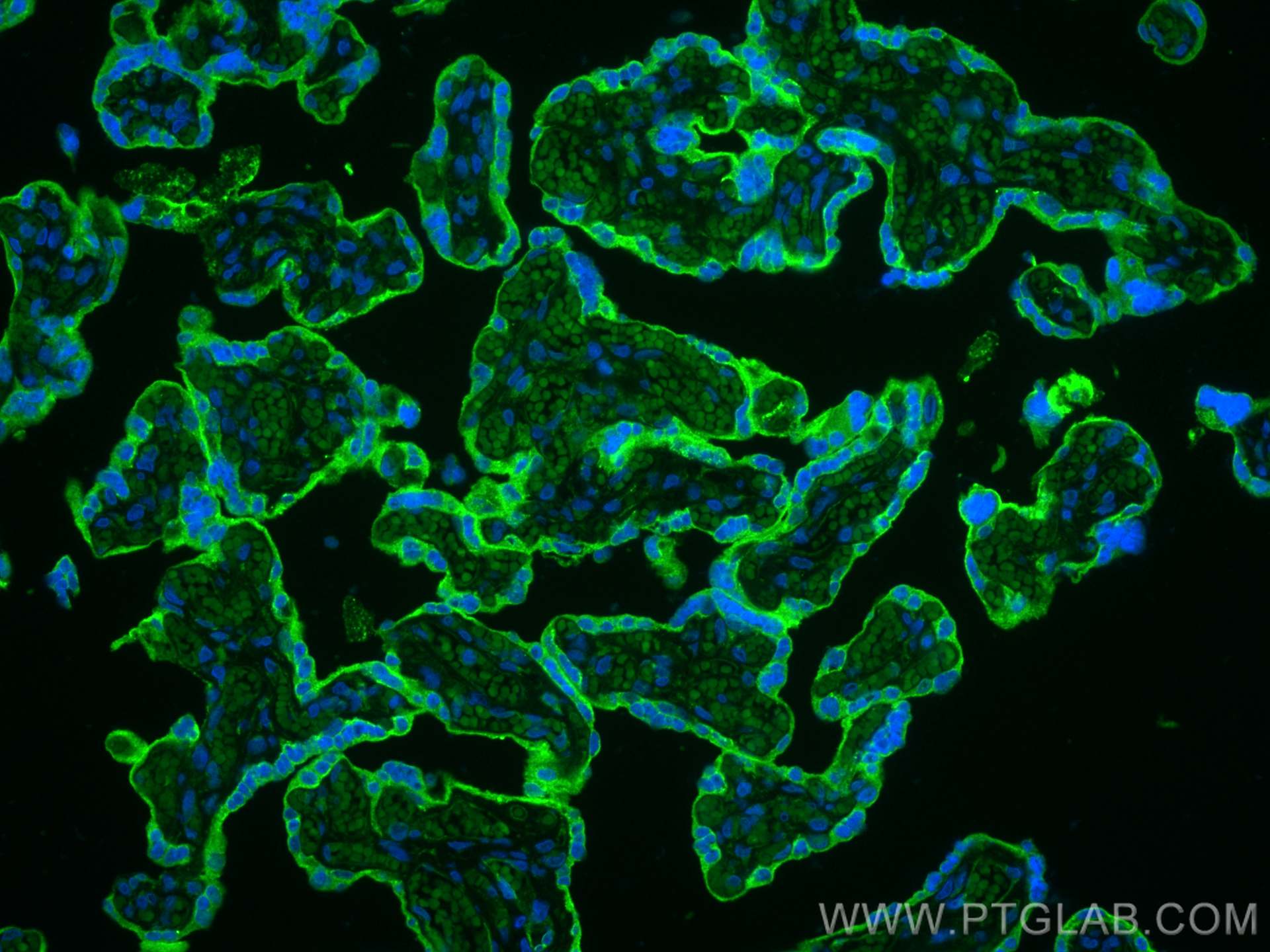 Immunofluorescence (IF) / fluorescent staining of human placenta tissue using CD39/ENTPD1 Polyclonal antibody (14211-1-AP)