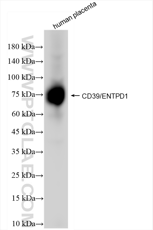 ENTPD1