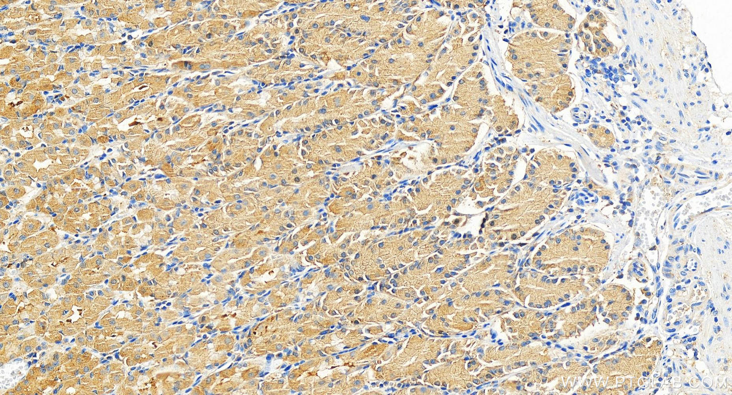 Immunohistochemistry (IHC) staining of human normal stomach using ENTPD8 Polyclonal antibody (18848-1-AP)