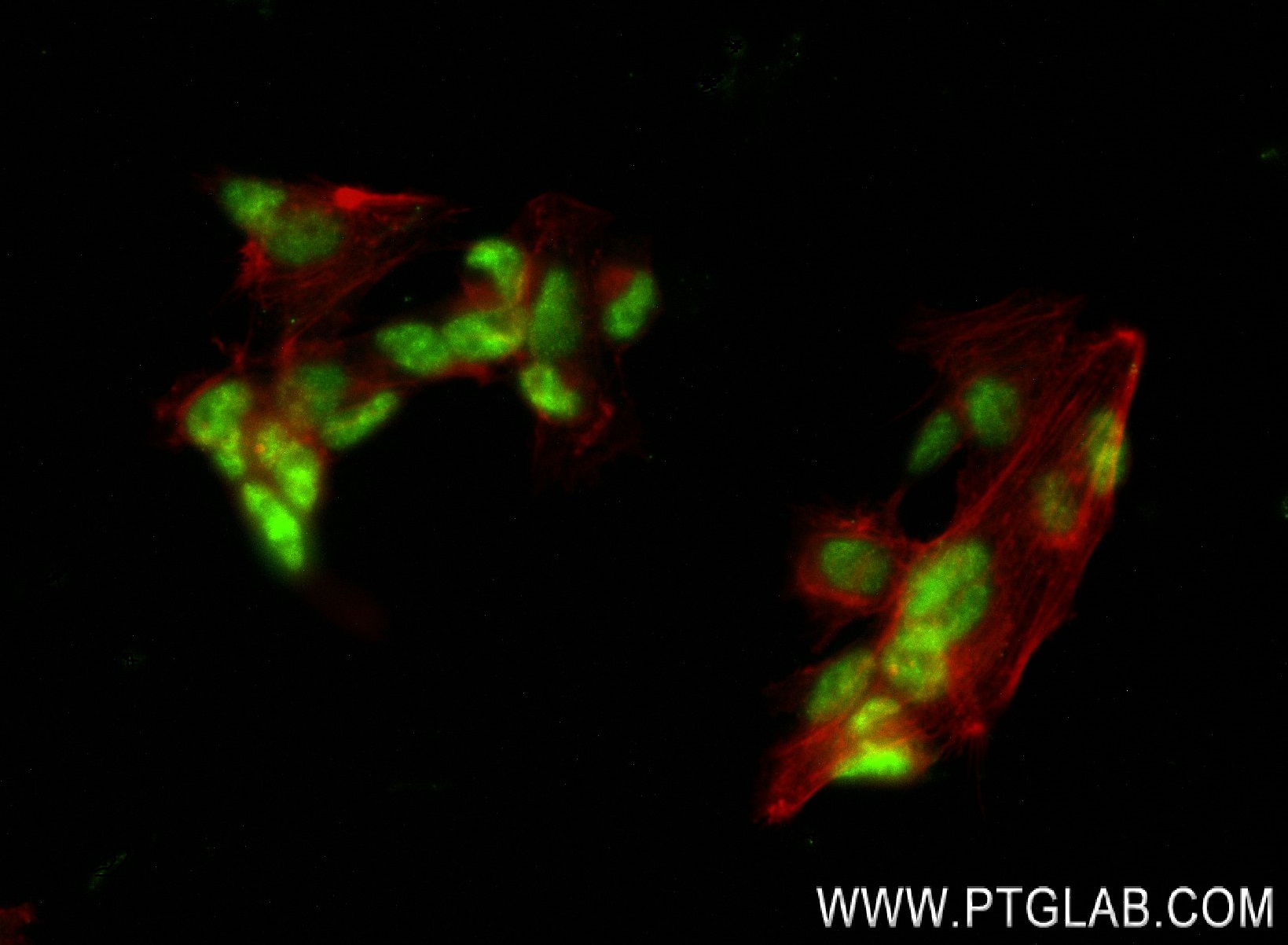 Immunofluorescence (IF) / fluorescent staining of SH-SY5Y cells using EOMES Recombinant antibody (83945-5-RR)