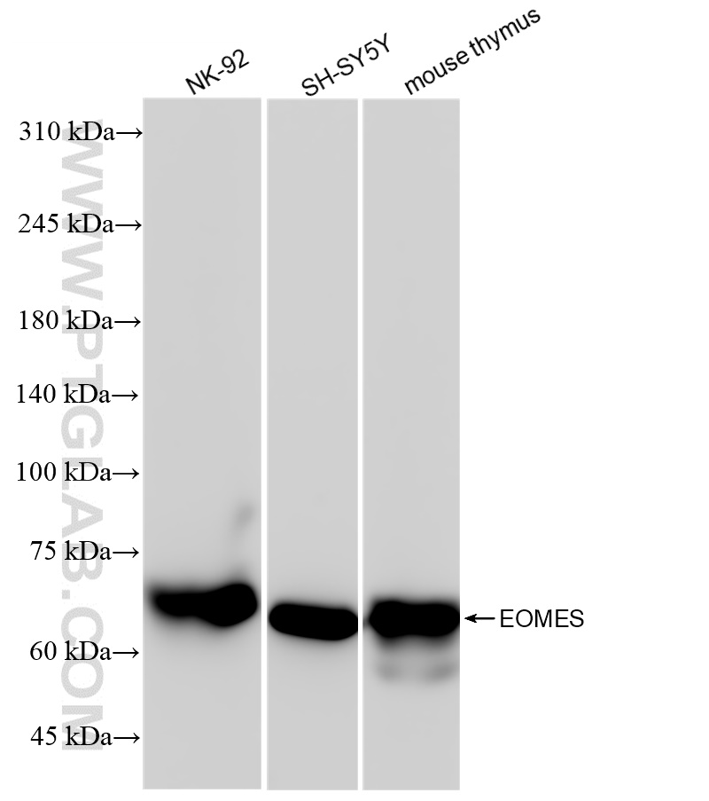 Western Blot (WB) analysis of various lysates using EOMES Recombinant antibody (83945-5-RR)