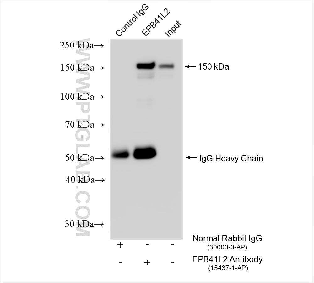 Immunoprecipitation (IP) experiment of HEK-293 cells using EPB41L2 Polyclonal antibody (15437-1-AP)