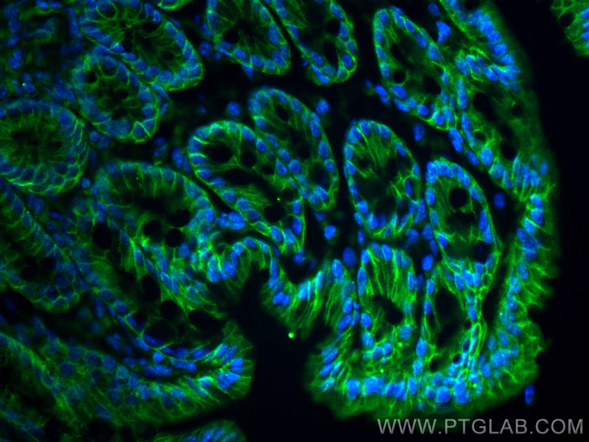 Immunofluorescence (IF) / fluorescent staining of mouse colon tissue using EPCAM/CD326 Polyclonal antibody (21050-1-AP)