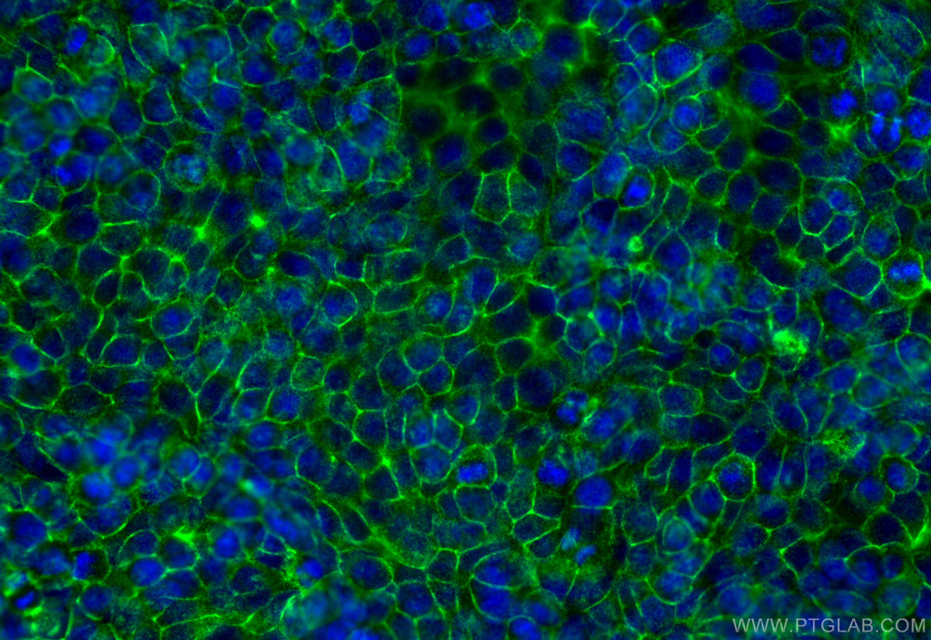 Immunofluorescence (IF) / fluorescent staining of HT-29 cells using EPCAM/CD326 Polyclonal antibody (21050-1-AP)