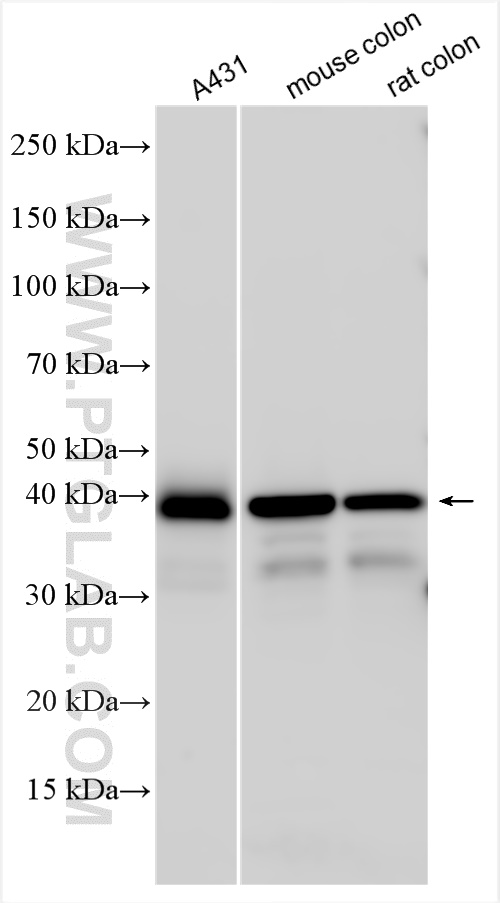 Western Blot (WB) analysis of various lysates using EPCAM/CD326 Polyclonal antibody (21050-1-AP)