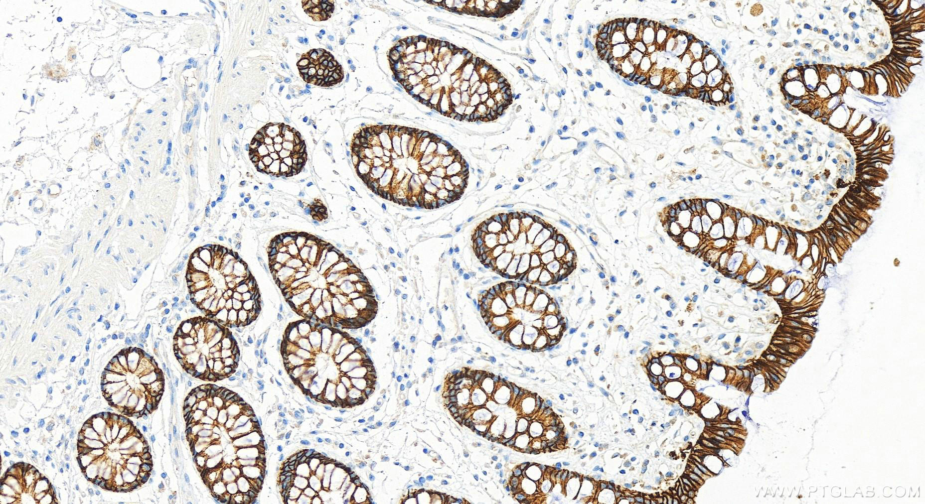 Immunohistochemistry (IHC) staining of Human colon tissue using EPCAM/CD326 Monoclonal antibody (66316-1-Ig)