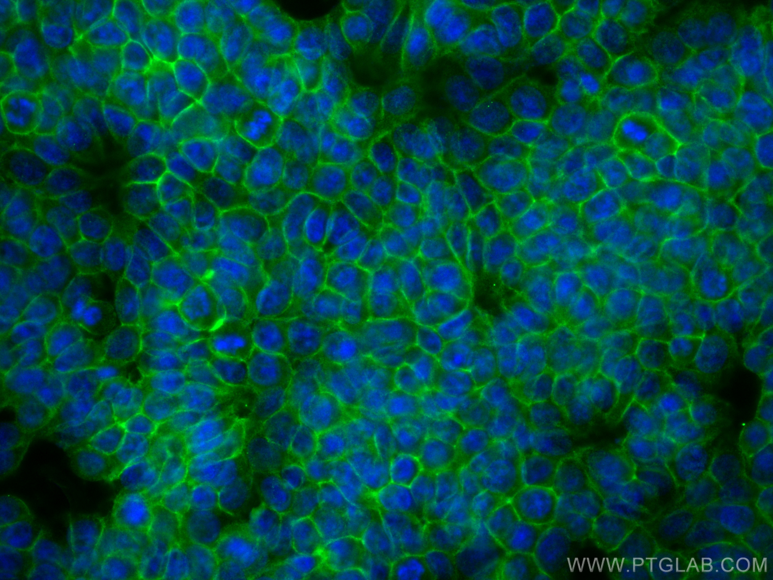 Immunofluorescence (IF) / fluorescent staining of HT-29 cells using EPCAM/CD326 Monoclonal antibody (66316-1-Ig)