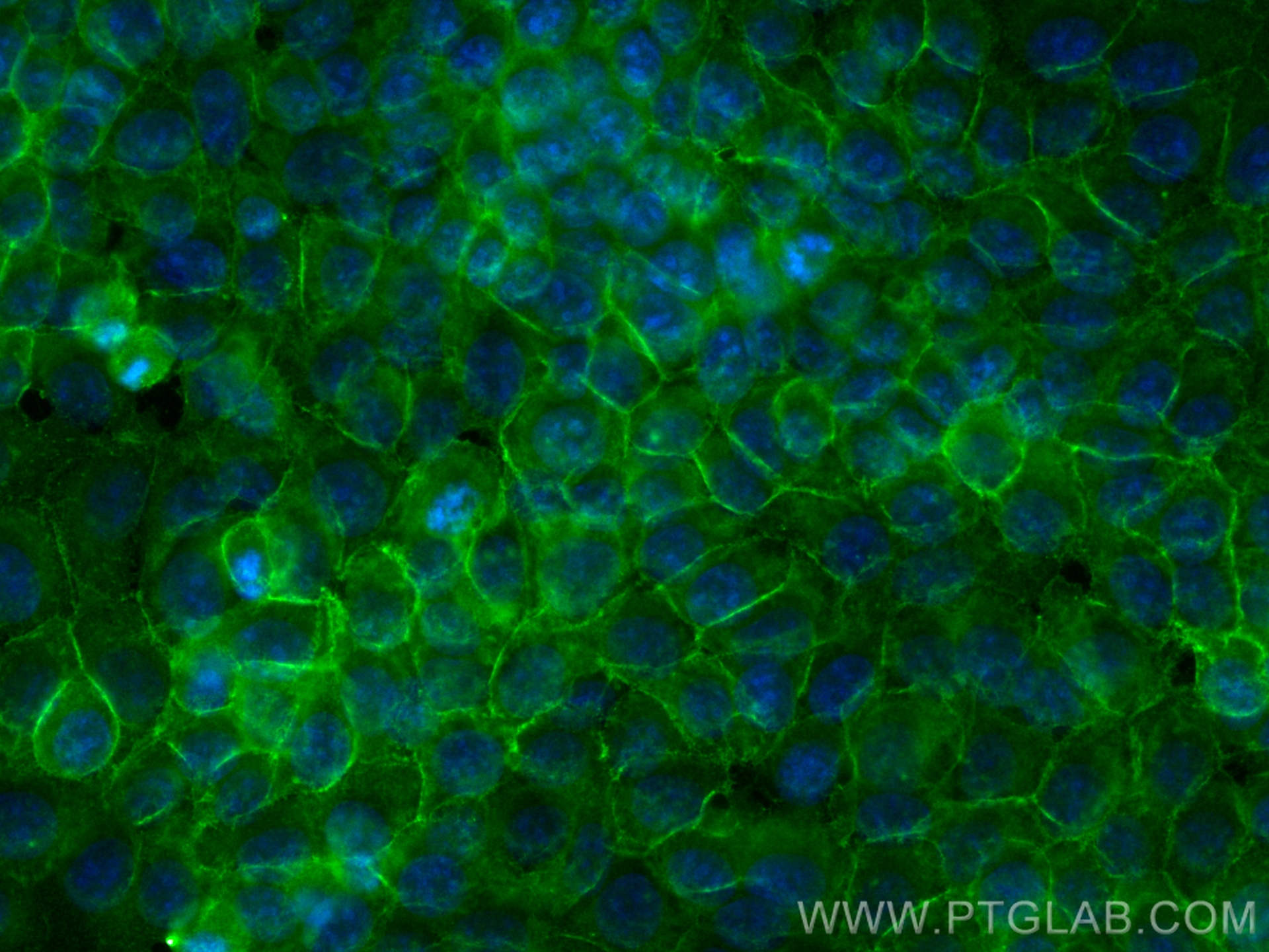 Immunofluorescence (IF) / fluorescent staining of MCF-7 cells using CoraLite® Plus 488-conjugated EPCAM/CD326 Polyclon (CL488-21050)