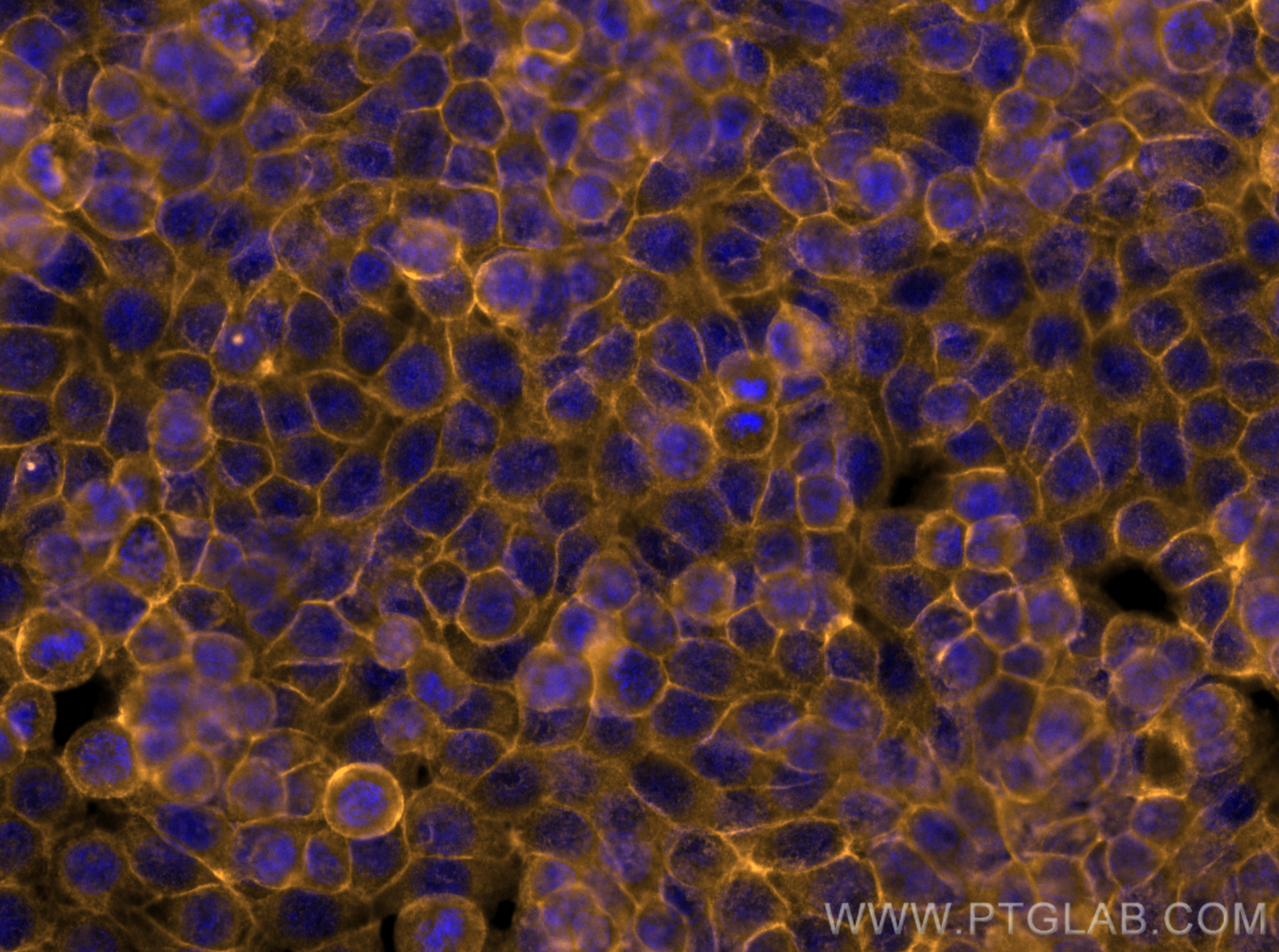 Immunofluorescence (IF) / fluorescent staining of HT-29 cells using CoraLite®555-conjugated EPCAM/CD326 Polyclonal ant (CL555-21050)